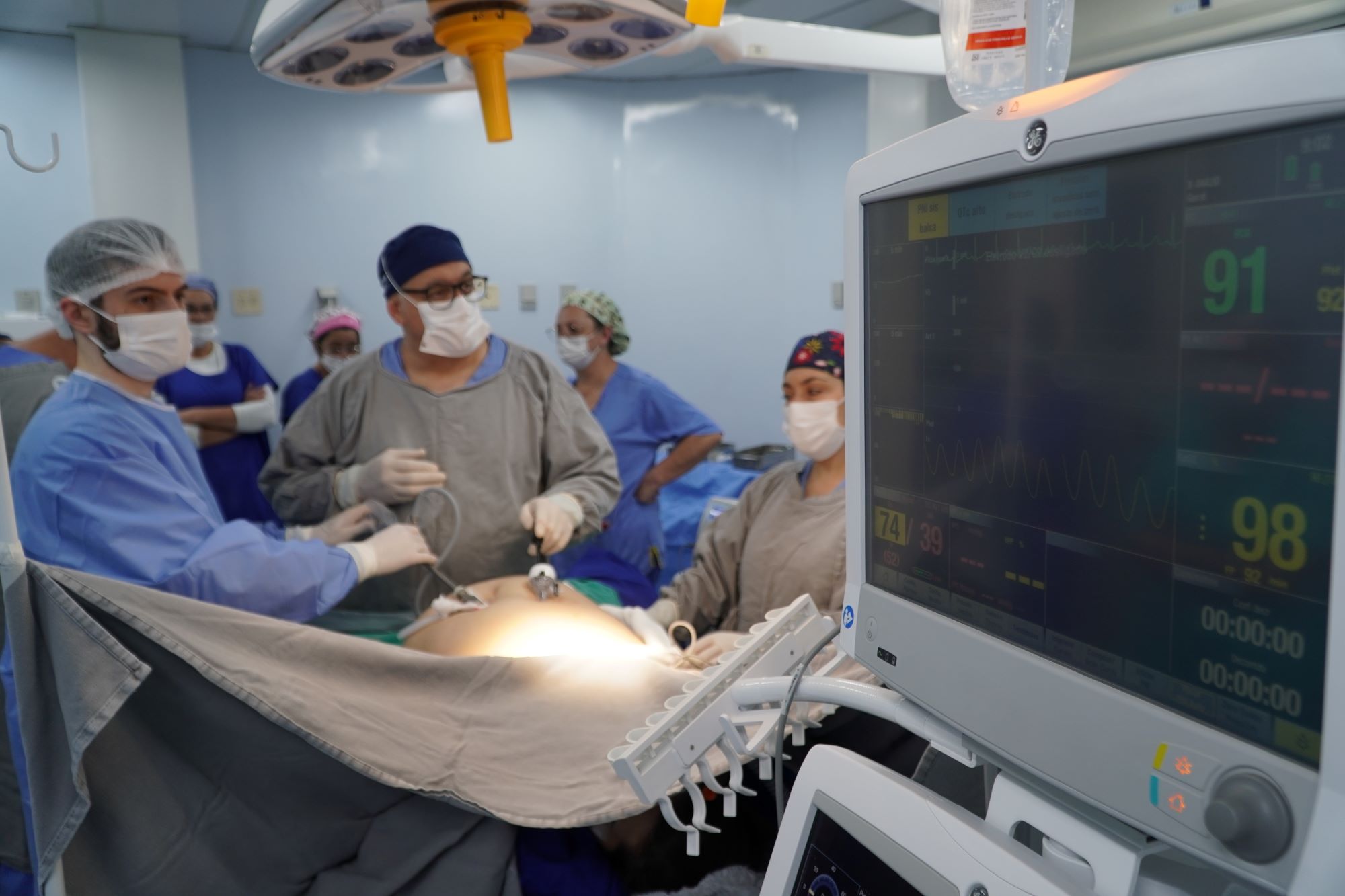 A imagem mostra uma equipe médica em um centro cirúrgico durante um procedimento. No primeiro plano, à direita, está um monitor multiparamétrico exibindo sinais vitais do paciente, como frequência cardíaca (91 bpm), saturação de oxigênio (98%) e pressão arterial.  Ao fundo, vários profissionais de saúde usam aventais cirúrgicos, luvas, toucas e máscaras, demonstrando um ambiente estéril. Dois médicos na frente parecem estar conduzindo a cirurgia, enquanto outros observam e auxiliam. A iluminação cirúrgica está direcionada para a área operada, que está parcialmente coberta por campos estéreis.  A cena transmite um clima de concentração, trabalho em equipe e cuidado técnico.