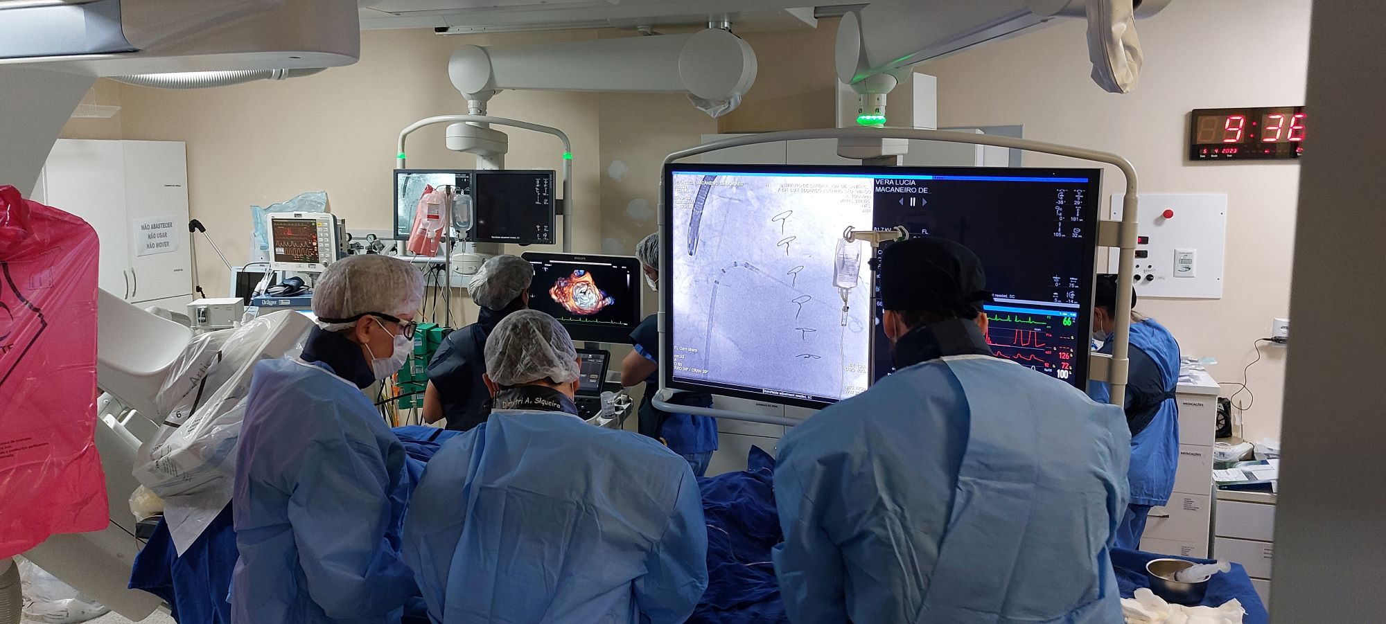 Equipe médica realiza procedimento cirúrgico em sala de hemodinâmica. Profissionais usam aventais cirúrgicos e toucas, enquanto acompanham imagens em tempo real exibidas em grandes monitores, incluindo imagens de ultrassom cardíaco e sinais vitais do paciente. O ambiente é altamente tecnológico, com equipamentos médicos avançados e iluminação controlada. Um relógio digital na parede mostra o horário como 9h36.