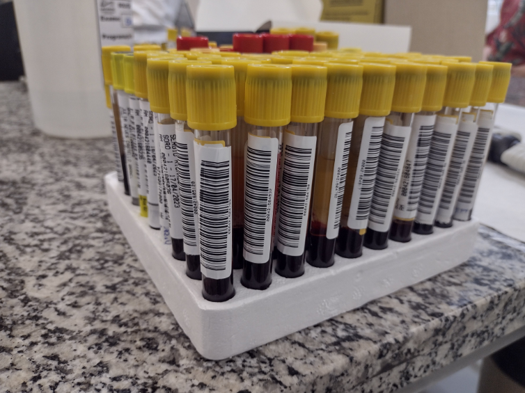 Rack de isopor contendo diversos tubos de ensaio com tampas amarelas, parcialmente preenchidos com amostras de sangue. Cada tubo possui uma etiqueta com código de barras para identificação. A imagem foi tirada sobre uma bancada de granito em um ambiente laboratorial.
