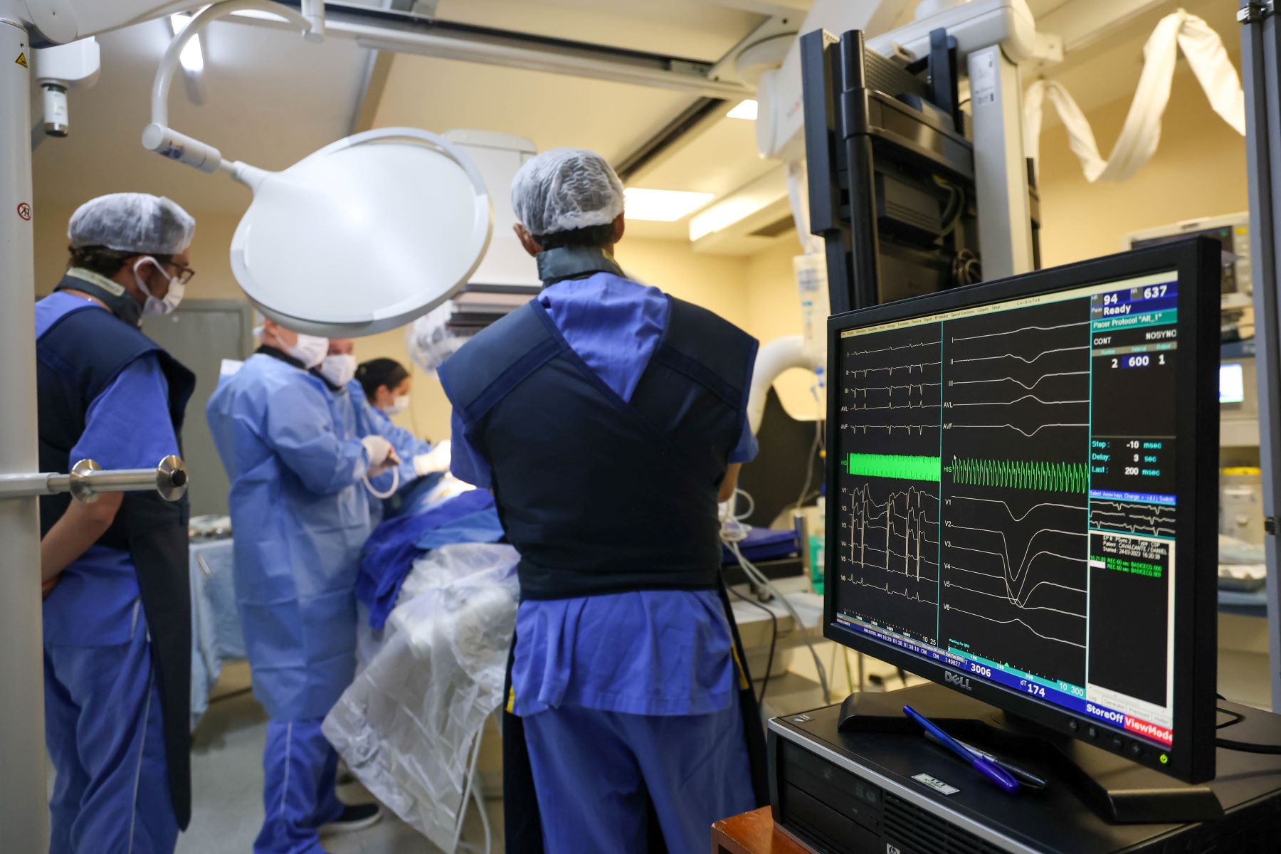 Profissionais da saúde realizam procedimento médico em um centro cirúrgico, vestindo roupas cirúrgicas e toucas. No primeiro plano, há um monitor exibindo sinais vitais e gráficos de eletrocardiograma do paciente. O ambiente está bem iluminado, com equipamentos médicos ao redor e foco cirúrgico sobre a mesa de operação.