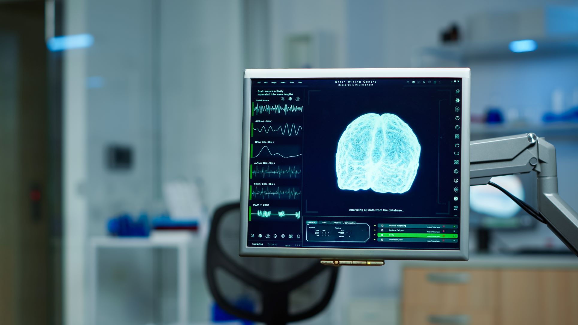 Tela de computador exibe imagem digital do cérebro com gráficos de atividade cerebral ao lado, representando ondas cerebrais como gama, beta, alfa e teta. O ambiente ao fundo é um consultório ou laboratório médico.