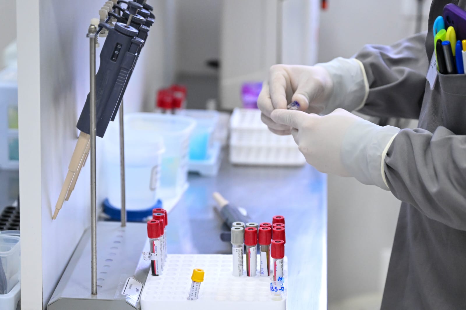 A imagem mostra um profissional de laboratório, vestindo jaleco cinza e luvas descartáveis, manuseando um pequeno tubo de ensaio.  No balcão de trabalho há suportes com pipetas automáticas, rack com tubos de coleta de sangue identificados por tampas coloridas (vermelhas, cinza e amarela) e recipientes plásticos transparentes. Ao fundo, é possível ver equipamentos e materiais de apoio usados em análises clínicas.  O ambiente é limpo, organizado e bem iluminado, transmitindo uma atmosfera de segurança e precisão nos procedimentos laboratoriais.