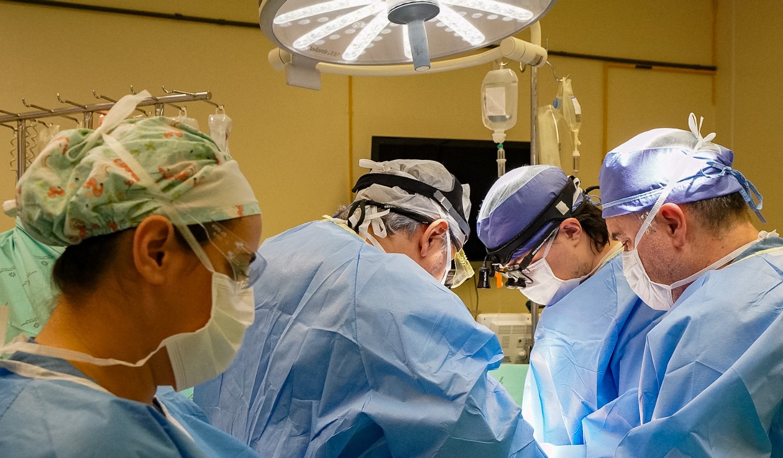 Equipe médica realiza uma cirurgia de transplante em uma sala de operação. Quatro profissionais estão concentrados sobre o paciente, vestidos com roupas cirúrgicas azuis, máscaras e toucas. Dois deles usam lupas cirúrgicas com iluminação acoplada. O ambiente está bem iluminado, com foco cirúrgico aceso e bolsas de soro penduradas ao fundo.