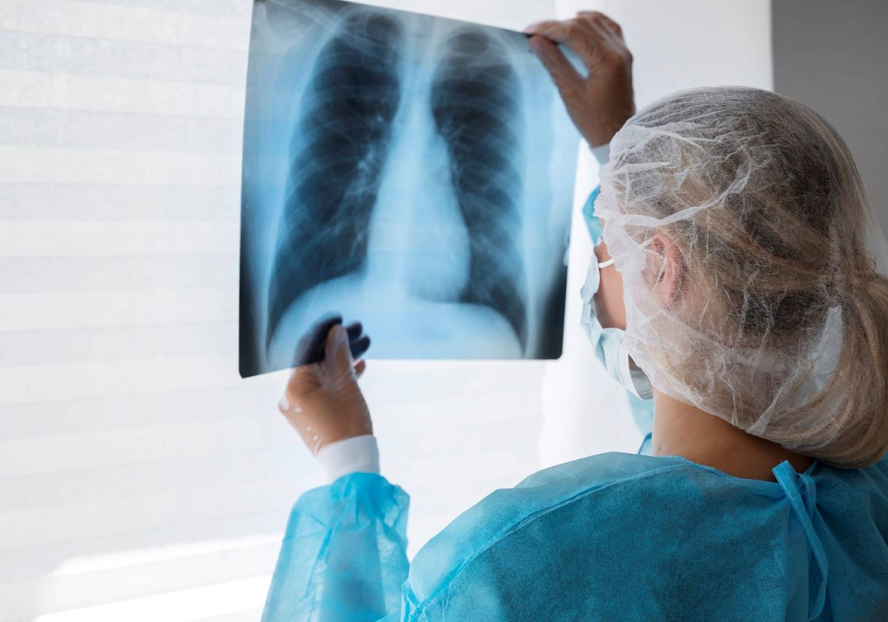 Tuberculose: Saúde SC reforça a importância do diagnóstico precoce e tratamento adequado para a cura da doença