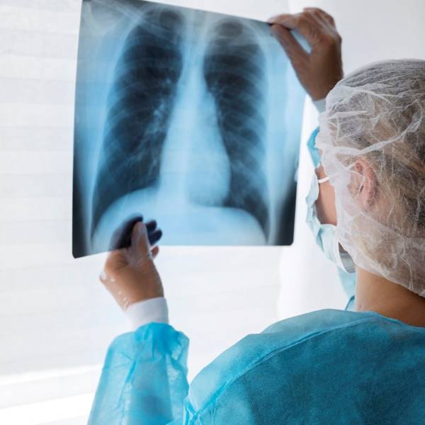 Tuberculose: Saúde SC reforça a importância do diagnóstico precoce e tratamento adequado para a cura da doença