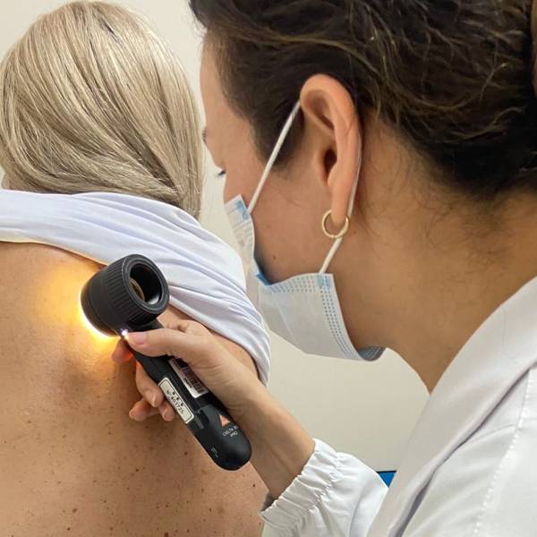 Estado reforça a importância da prevenção e do diagnóstico precoce do melanoma