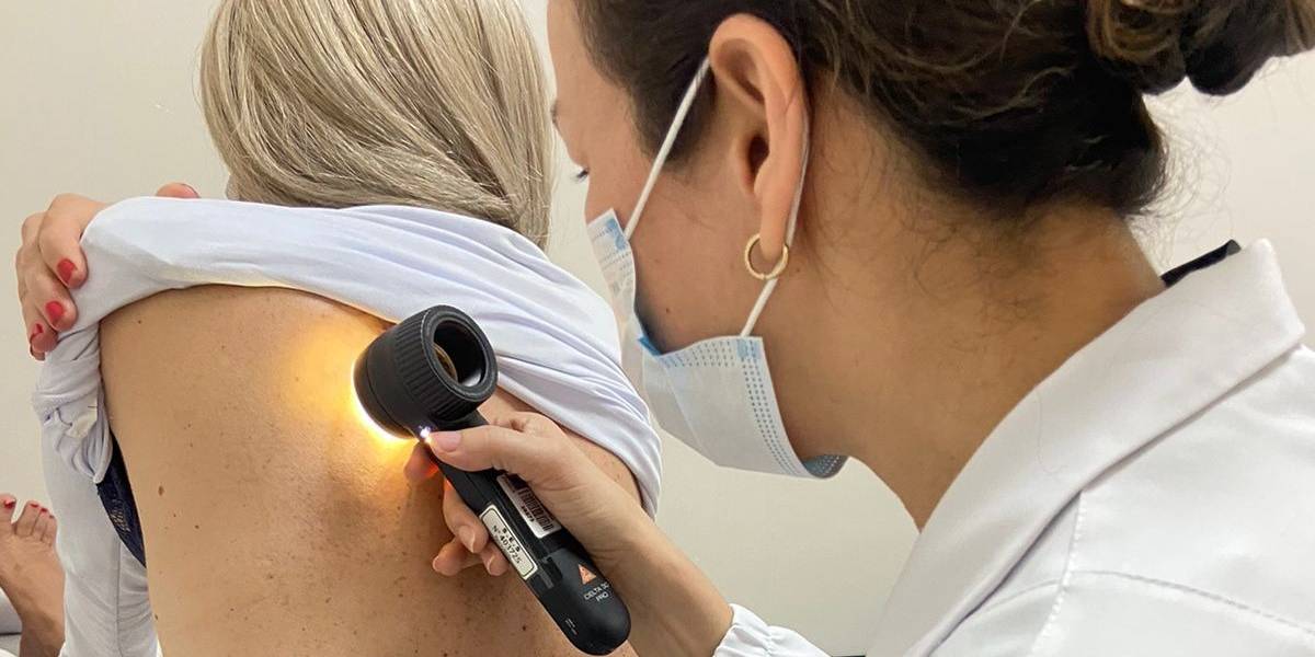 Estado reforça a importância da prevenção e do diagnóstico precoce do melanoma