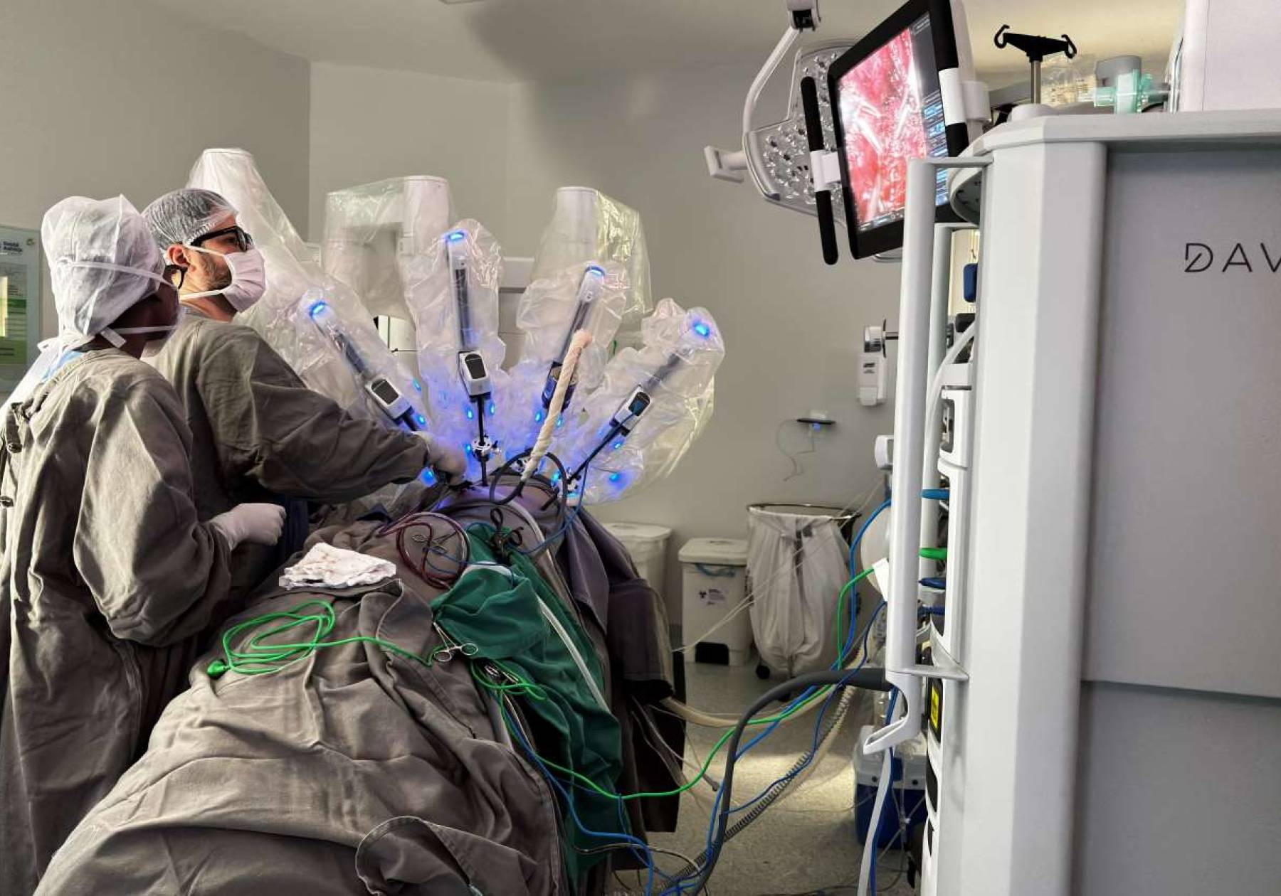 Hospital Azambuja realiza primeira cirurgia robótica oncológica pelo SUS em Santa Catarina