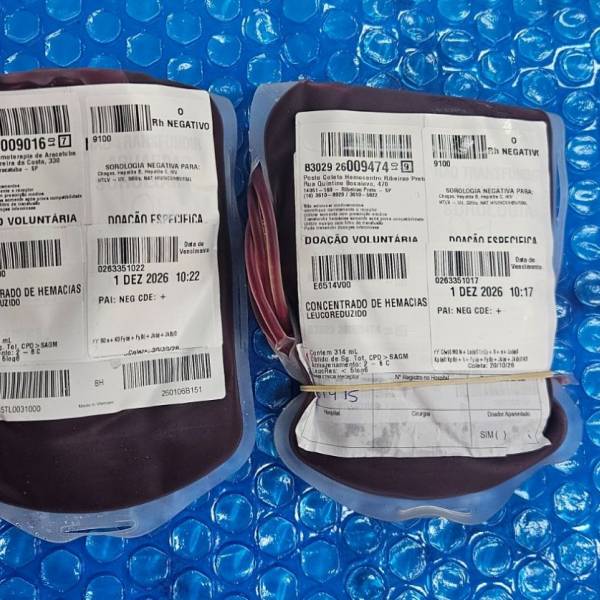 Bolsas de sangue raro chegam a Santa Catarina para atender paciente com anemia falciforme